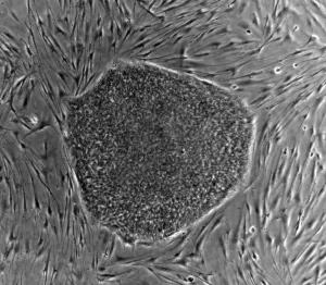 Image is of human embryonic stem (hES) cell colony on a mouse embryonic fibroblast (MEF) feeder layer